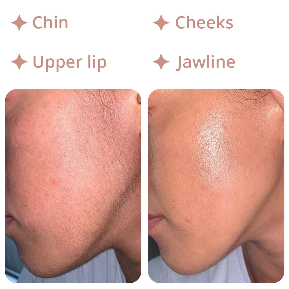 18K Epilator - Pro Facial Hair Remover